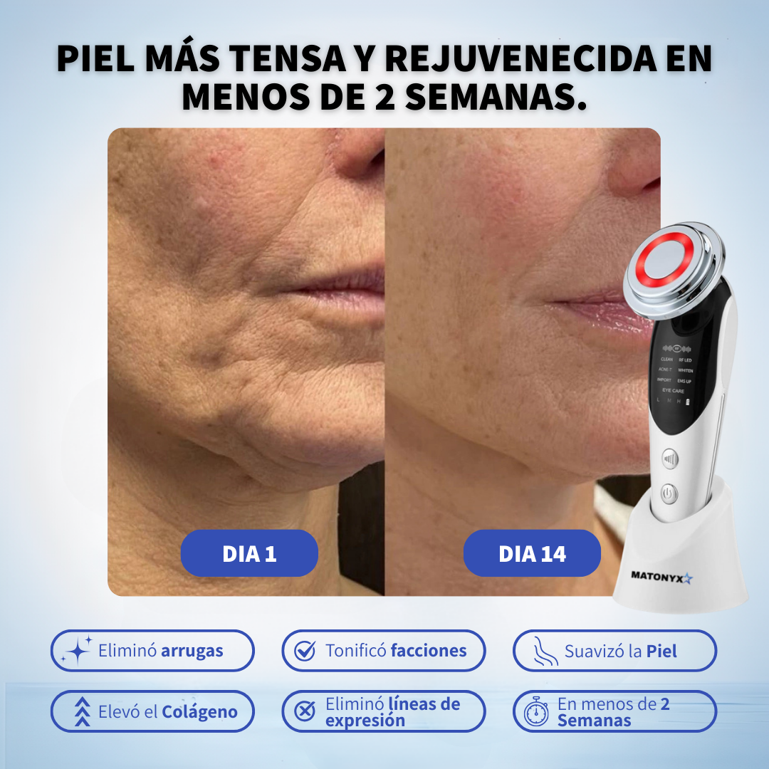 Masajeador Facial con frio y calor Antiarrugas + 2 Mascarillas de Colágeno GRATIS