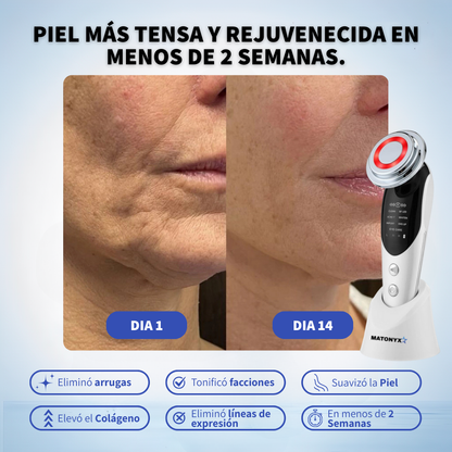 Masajeador Facial con frio y calor Antiarrugas + 2 Mascarillas de Colágeno GRATIS