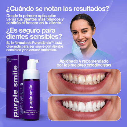 PurpleSmile™ | Di adiós a años de manchas y mal aliento