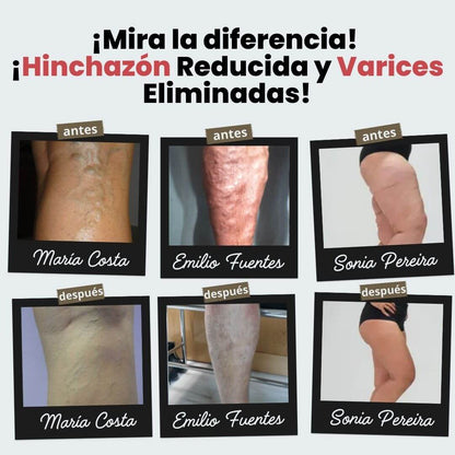 Medias de acupresión Anti-Varices